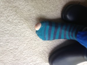 hole in sock